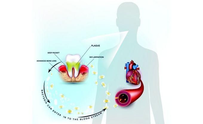 Du lien entre santé buccale et santé générale