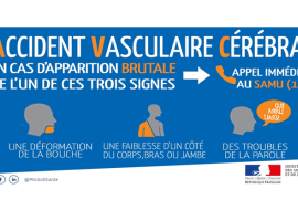 AVC : les signes d'alerte !