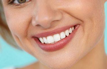 Comment prendre soin de ses dents ? 